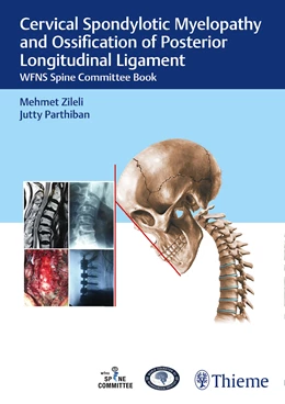 Abbildung von Zileli / Parthiban | Cervical Spondylotic Myelopathy and Ossification of Posterior Longitudinal Ligament | 1. Auflage | 2022 | beck-shop.de