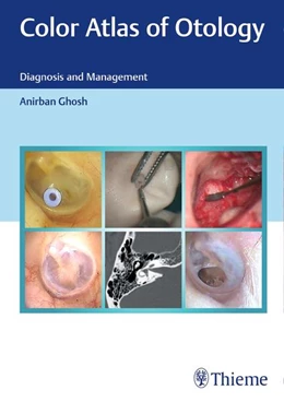 Abbildung von Ghosh | Color Atlas of Otology | 1. Auflage | 2022 | beck-shop.de