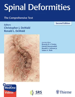 Abbildung von DeWald | Spinal Deformities | 2. Auflage | 2024 | beck-shop.de