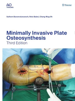 Abbildung von Bavonratanavech / Babst | Minimally Invasive Plate Osteosynthesis | 3. Auflage | 2023 | beck-shop.de