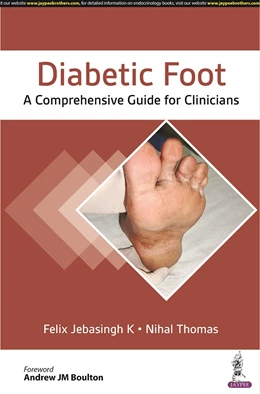Abbildung von K / Thomas | Diabetic Foot | 1. Auflage | 2022 | beck-shop.de