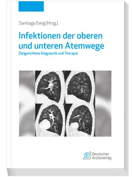 Abbildung von Ewig | Infektionen der oberen und unteren Atemwege | 1. Auflage | 2023 | beck-shop.de