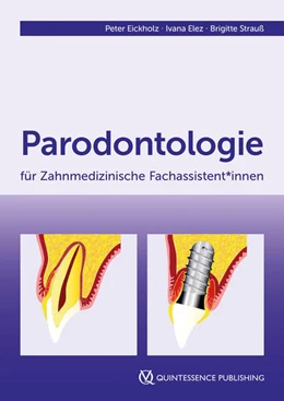 Abbildung von Eickholz / Elez | Parodontologie für Zahnmedizinische Fachassistent*innen | 1. Auflage | 2024 | beck-shop.de