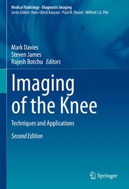 Abbildung von Davies / James | Imaging of the Knee | 2. Auflage | 2023 | beck-shop.de