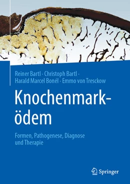 Abbildung von Bartl / Bonél | Knochenmarködem | 1. Auflage | 2023 | beck-shop.de
