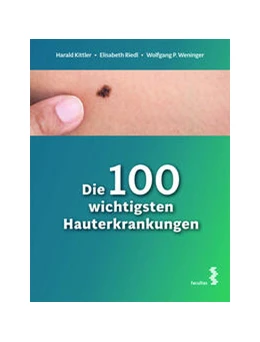 Abbildung von Kittler / Riedl | Die 100 wichtigsten Hauterkrankungen | 1. Auflage | 2024 | beck-shop.de
