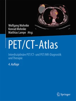 Abbildung von Mohnike / Mohnike | PET/CT-Atlas | 4. Auflage | 2024 | beck-shop.de