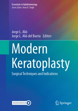 Abbildung von Alió / del Barrio | Modern Keratoplasty | 1. Auflage | 2023 | beck-shop.de