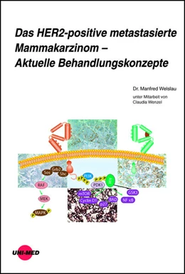 Abbildung von Welslau | Das HER2-positive metastasierte Mammakarzinom - Aktuelle Behandlungskonzepte | 1. Auflage | 2023 | beck-shop.de