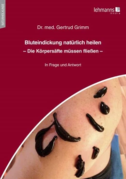 Abbildung von Grimm | Bluteindickung natürlich heilen | 1. Auflage | 2023 | beck-shop.de