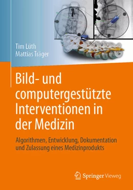 Abbildung von Lüth / Träger | Bild- und computergestützte Interventionen in der Medizin | 1. Auflage | 2024 | beck-shop.de