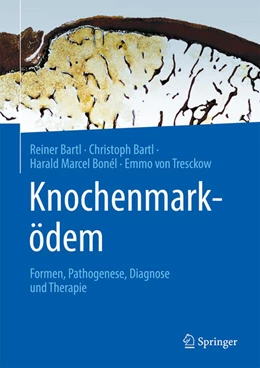 Abbildung von Bartl / Bonél | Knochenmarködem | 1. Auflage | 2023 | beck-shop.de