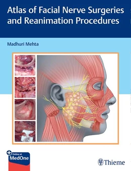 Abbildung von Mehta | Atlas of Facial Nerve Surgeries and Reanimation Procedures | 1. Auflage | 2024 | beck-shop.de