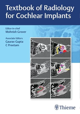 Abbildung von Grover | Textbook of Radiology for Cochlear Implants | 1. Auflage | 2024 | beck-shop.de