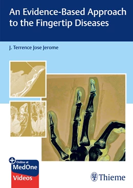 Abbildung von Jerome | An Evidence-Based Approach to the Fingertip Diseases | 1. Auflage | 2024 | beck-shop.de