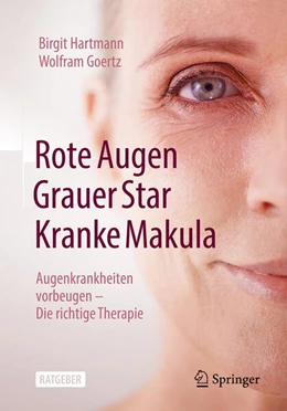 Abbildung von Hartmann / Goertz | Rote Augen, Grauer Star, Kranke Makula | 1. Auflage | 2023 | beck-shop.de