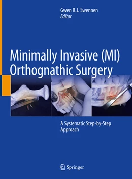Abbildung von Swennen | Minimally Invasive (MI) Orthognathic Surgery | 1. Auflage | 2023 | beck-shop.de