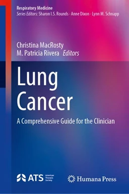 Abbildung von MacRosty / Rivera | Lung Cancer | 1. Auflage | 2023 | beck-shop.de