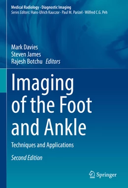 Abbildung von Davies / James | Imaging of the Foot and Ankle | 2. Auflage | 2023 | beck-shop.de