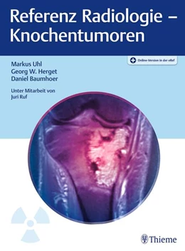 Abbildung von Uhl / Herget | Referenz Radiologie - Knochentumoren | 1. Auflage | 2022 | beck-shop.de