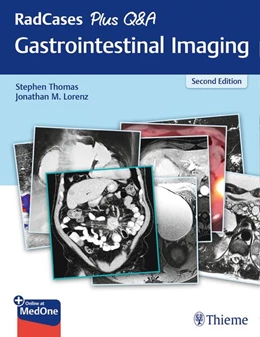Abbildung von Thomas / Lorenz | RadCases Plus Q&A Gastrointestinal Imaging | 2. Auflage | 2020 | beck-shop.de