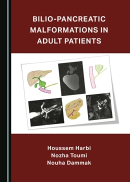 Abbildung von Dammak / Toumi | Bilio-Pancreatic Malformations in Adult Patients | 1. Auflage | 2023 | beck-shop.de