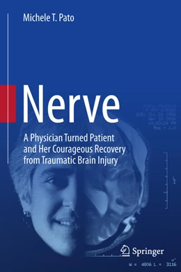 Abbildung von Pato | Nerve | 1. Auflage | 2023 | beck-shop.de