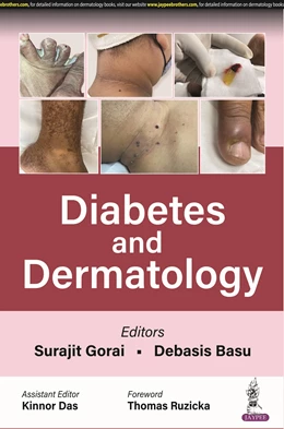 Abbildung von Gorai / Basu | Diabetes and Dermatology | 1. Auflage | 2023 | beck-shop.de