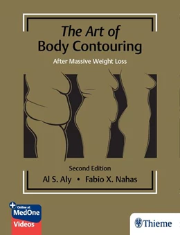 Abbildung von Aly / Nahas | The Art of Body Contouring: After Massive Weight Loss | 2. Auflage | 2023 | beck-shop.de
