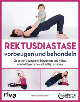 Abbildung von Wiechers | Rektusdiastase vorbeugen und behandeln | 1. Auflage | 2023 | beck-shop.de