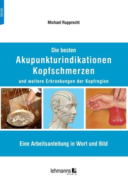 Abbildung von Rupprecht | Die besten Akupunkturindikationen Kopfschmerzen und weitere Erkrankungen der Kopfregion | 1. Auflage | 2023 | beck-shop.de