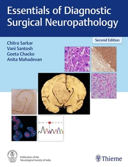 Abbildung von Sarkar / Santosh | Essentials of Diagnostic Surgical Neuropathology | 2. Auflage | 2023 | beck-shop.de