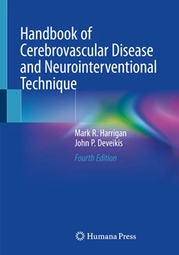 Abbildung von Harrigan / Deveikis | Handbook of Cerebrovascular Disease and Neurointerventional Technique | 4. Auflage | 2024 | beck-shop.de