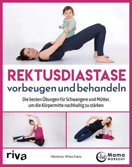 Abbildung von Wiechers | Rektusdiastase vorbeugen und behandeln | 1. Auflage | 2023 | beck-shop.de