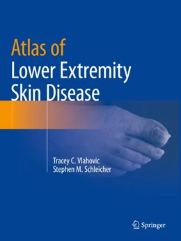Abbildung von Vlahovic / Schleicher | Atlas of Lower Extremity Skin Disease | 1. Auflage | 2023 | beck-shop.de