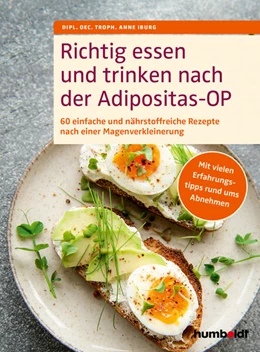 Abbildung von Iburg | Richtig essen und trinken nach der Adipositas-OP | 1. Auflage | 2024 | beck-shop.de