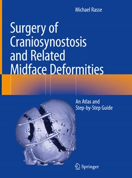 Abbildung von Rasse | Surgery of Craniosynostosis and Related Midface Deformities | 1. Auflage | 2024 | beck-shop.de