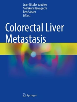 Abbildung von Vauthey / Kawaguchi | Colorectal Liver Metastasis | 1. Auflage | 2023 | beck-shop.de