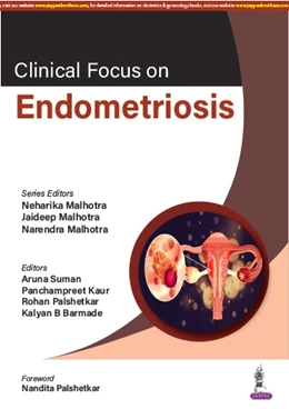 Abbildung von Malhotra | Clinical Focus on Endometriosis | 1. Auflage | 2023 | beck-shop.de
