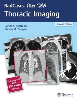 Abbildung von Restrepo / Zangan | RadCases Plus Q&A Thoracic Imaging | 2. Auflage | 2019 | beck-shop.de