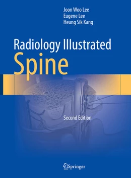 Abbildung von Lee / Kang | Radiology Illustrated: Spine | 2. Auflage | 2023 | beck-shop.de