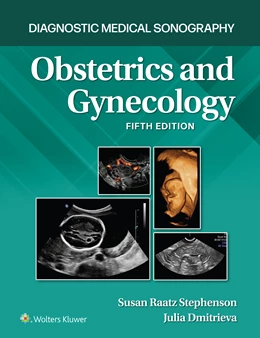 Abbildung von Stephenson / Dmitrieva | Diagnostic Medical Sonography: Obstetrics and Gynecology 5e Lippincott Connect Print Book and Digital Access Card Package | 5. Auflage | 2023 | beck-shop.de