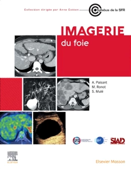 Abbildung von Paisant / Mulé | Imagerie du foie | 1. Auflage | 2024 | beck-shop.de