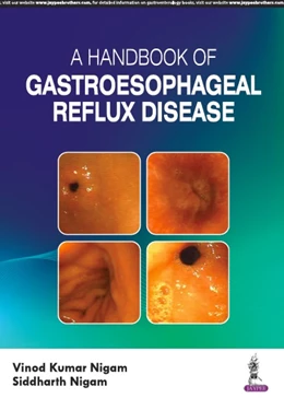 Abbildung von Nigam | A Handbook of Gastroesophageal Reflux Disease (GERD) | 1. Auflage | 2023 | beck-shop.de