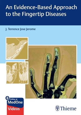Abbildung von Jerome | An Evidence-Based Approach to the Fingertip Diseases | 1. Auflage | 2024 | beck-shop.de
