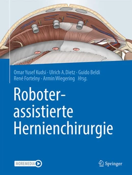 Abbildung von Kudsi / Dietz | Roboterassistierte Hernienchirurgie | 1. Auflage | 2024 | beck-shop.de