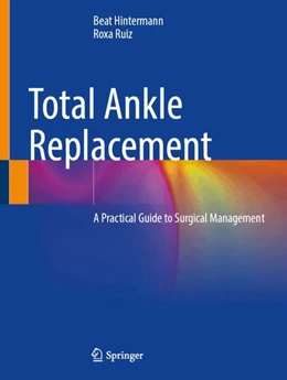 Abbildung von Hintermann / Ruiz | Total Ankle Replacement | 1. Auflage | 2024 | beck-shop.de