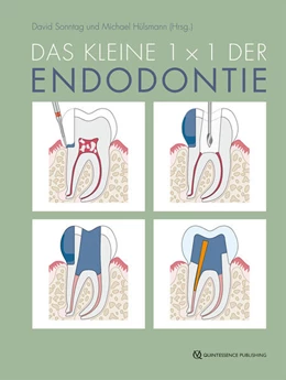 Abbildung von Sonntag / Hülsmann | Das kleine 1x1 der Endodontie | 1. Auflage | 2024 | beck-shop.de