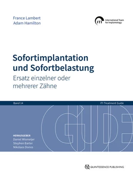 Abbildung von Wismeijer / Barter | Sofortimplantation und Sofortbelastung | 1. Auflage | 2024 | 14 | beck-shop.de