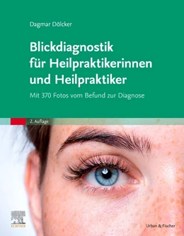 Abbildung von Dölcker | Blickdiagnostik für Heilpraktikerinnen und Heilpraktiker | 2. Auflage | 2024 | beck-shop.de